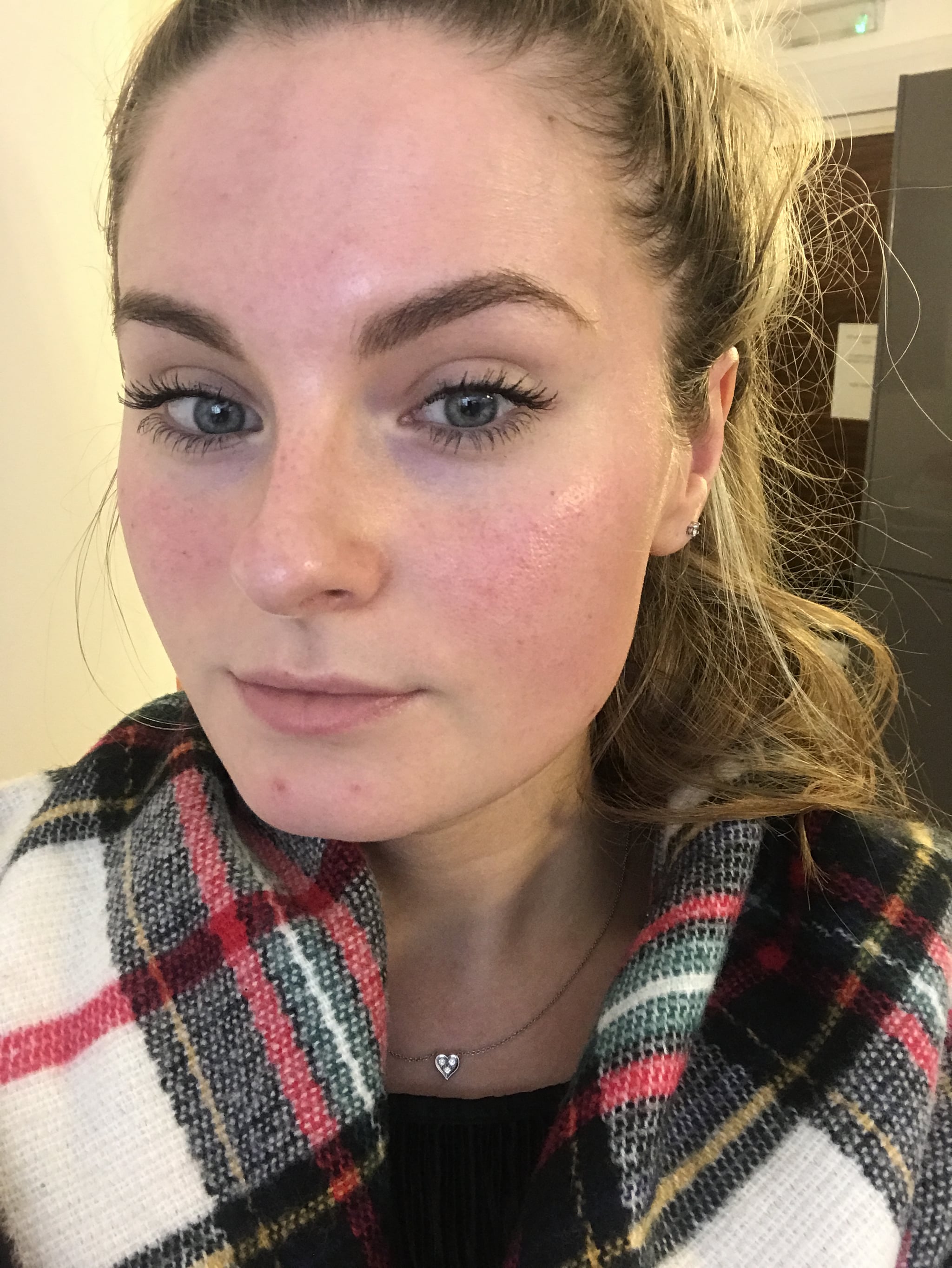 dermaplaning hair regrowth reddit