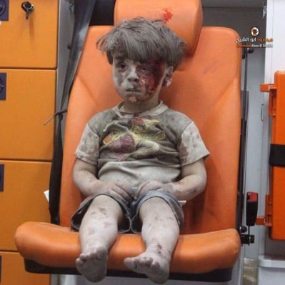 Photo and Video of Confused Syrian Boy Injured in Aleppo