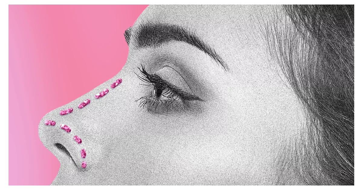 "Tip Lift" Nose Job Procedure Recovery, BeforeandAfters POPSUGAR