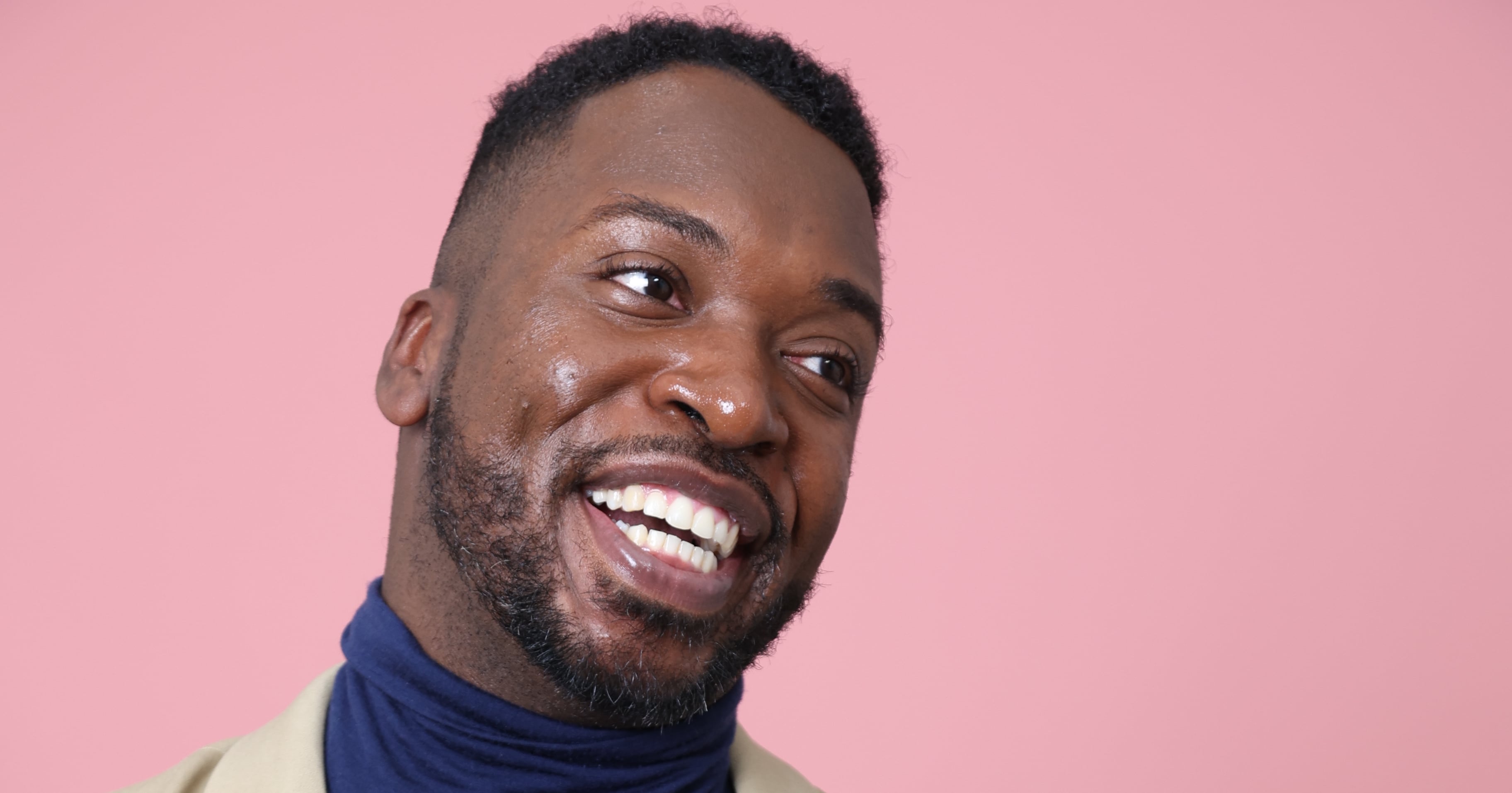 How I Stopped Chasing the Perfect Hairline and Started Owning Mine