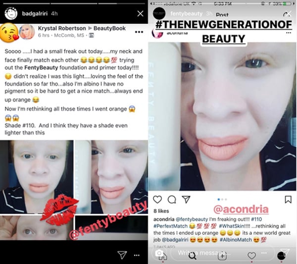 Fenty Beauty Foundation Gets Viral Review From Albino Woman