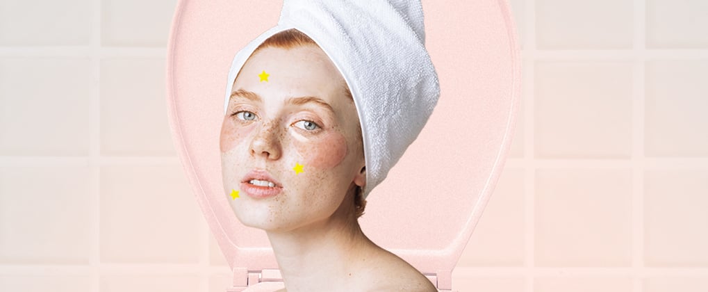 Does Showering With the Toilet Lid Open Cause Acne?