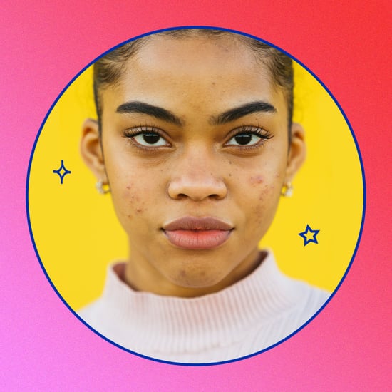 Why We Need to Normalize Having Acne
