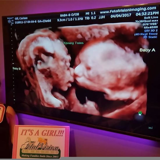 Twins Kissing in Sonogram