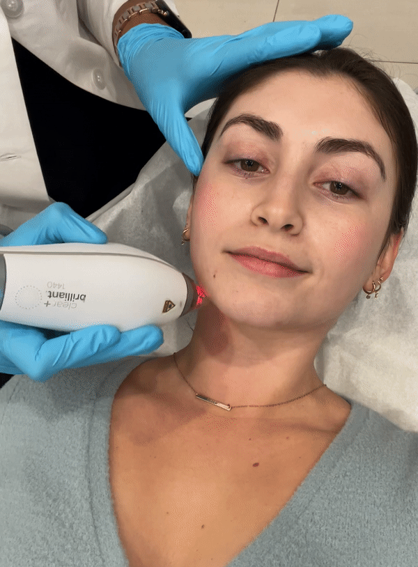 Clear + Brilliant Laser Review