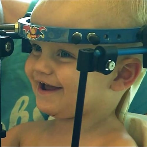 Toddler Survives Internal Decapitation