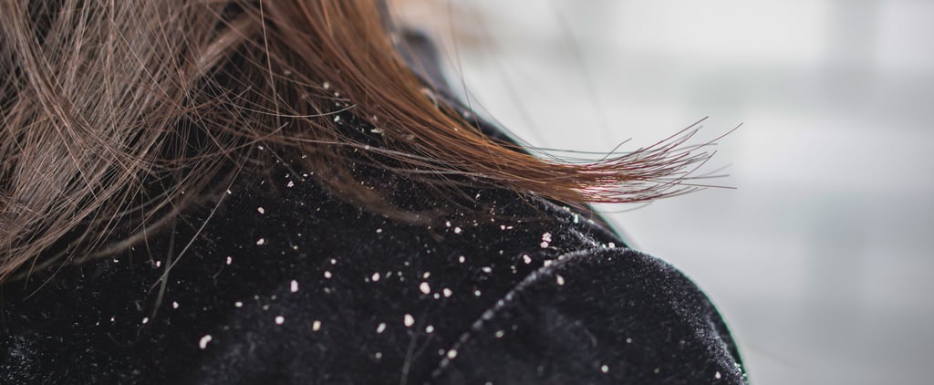 Does Stress Cause Dandruff? We Ask the Experts