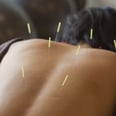 My Fear of Needles Didn't Stop Me From Getting Acupuncture, and Here's Why I'll Be Going Back