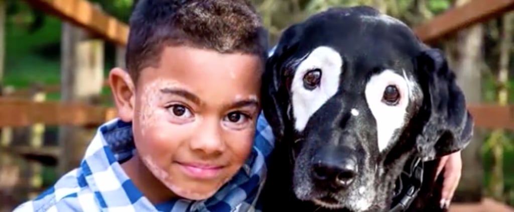 Boy With Vitiligo Meets Dog With Same Condition