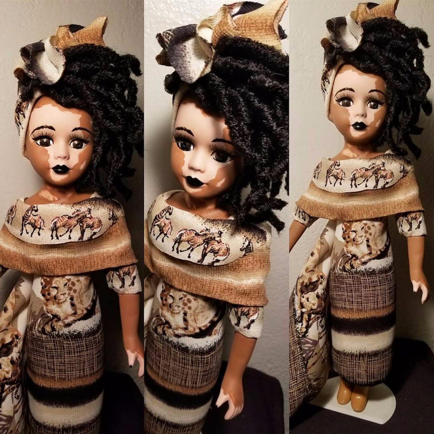 vitiligo bratz doll