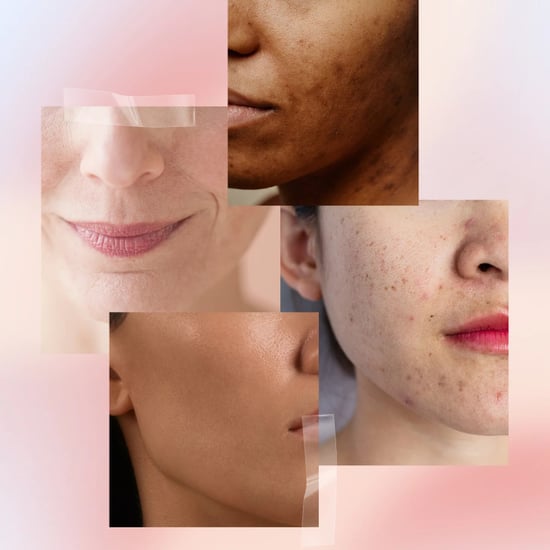 Skin Type Quiz: What Is Your Skin Type?