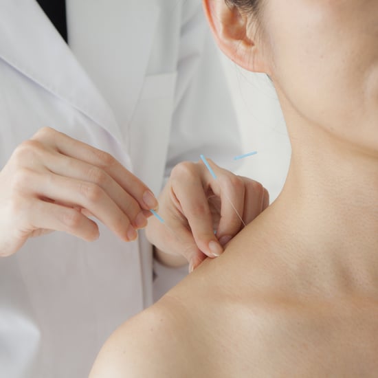 Acupuncture Side Effects to Know About Before Your Treatment