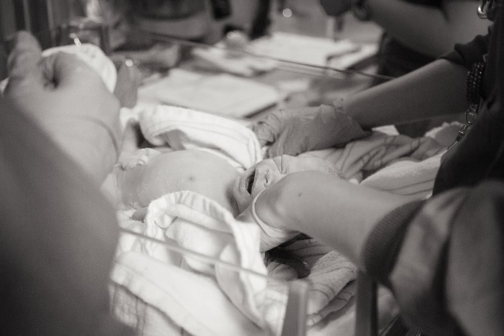 Photographs of Twin Birth