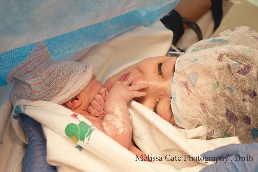 C-Section Birth Photography