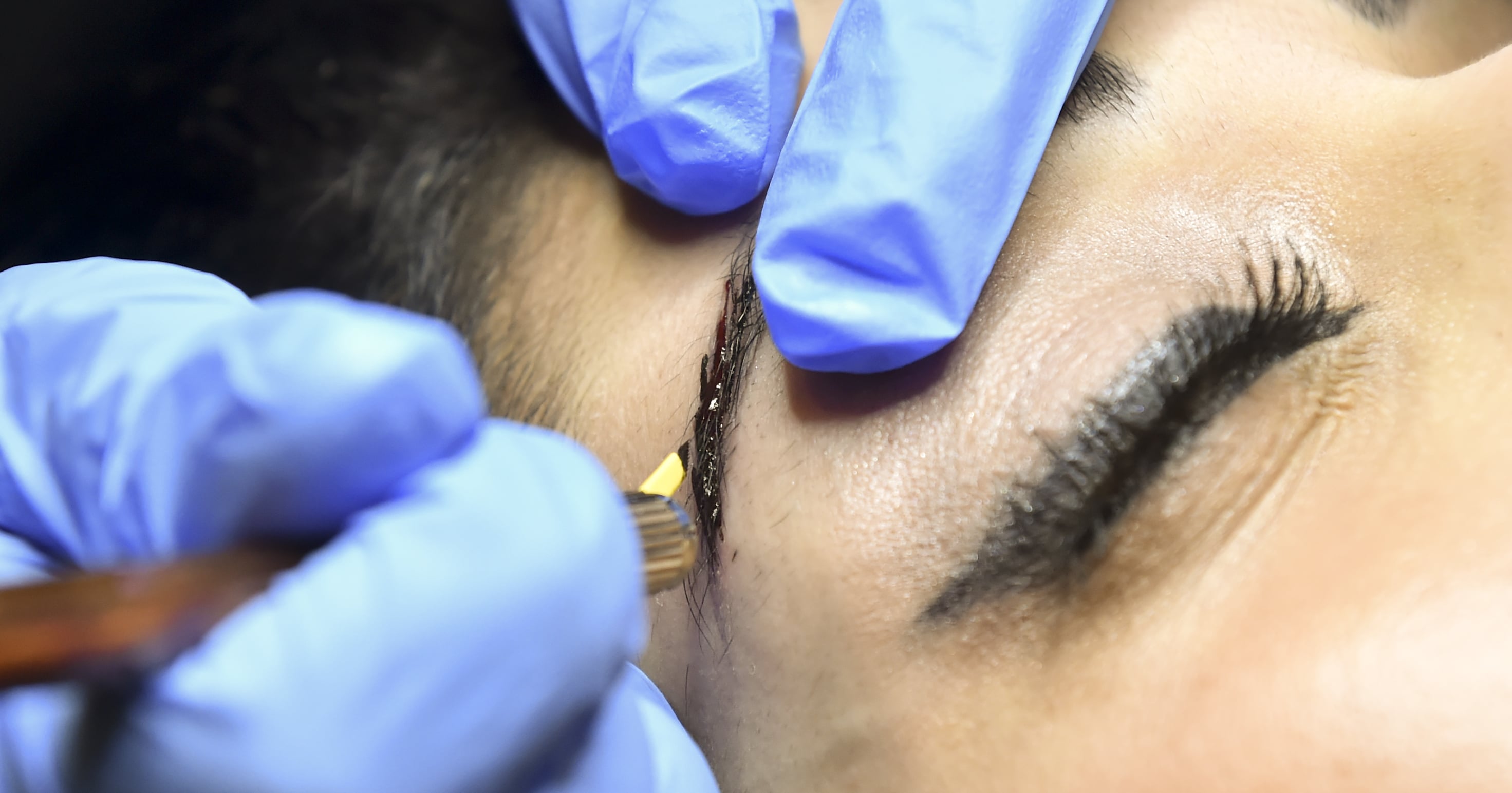 What Is Microblading? A Dermatologist Weighs In