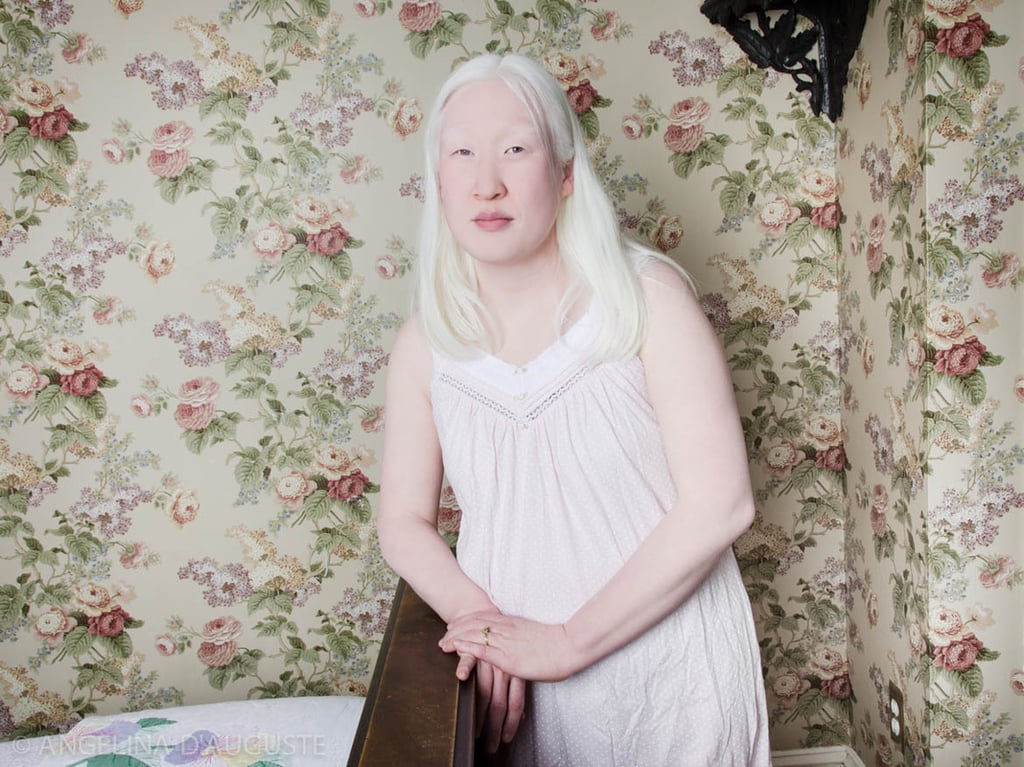Nude Albino Women Pictures Sexy Nipple