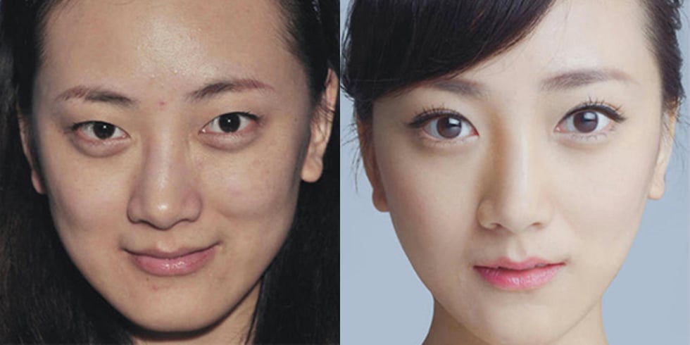 Extreme Plastic Surgery Causes Passport Confusion