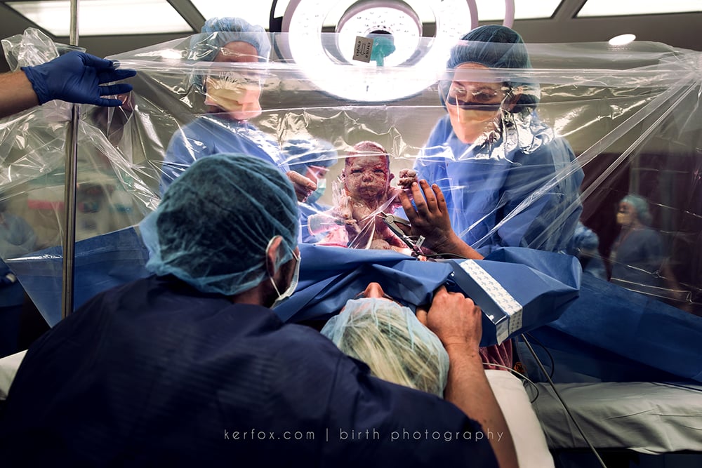 With her head propped up by her partner, this mom got a clear view of her little one entering the world.

    Related:

            
            
                                    
                            

            These C-Section Photos Featuring Clear Drapes Between Mom and Baby Will Blow Your Damn Mind