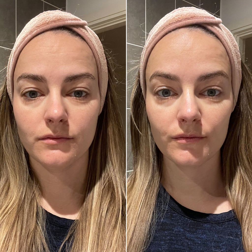 Shani Darden Facial Sculpting Wand Review POPSUGAR Beauty