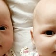These Parents Wouldn't Change the Fact 1 of Their Twins Has Down Syndrome "For the World"
