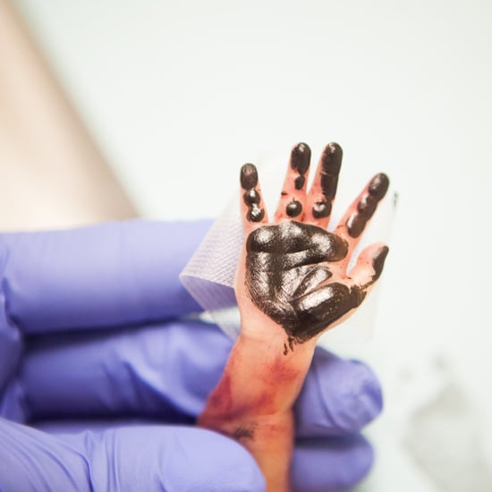 Photos of Baby Born Early at 23 Weeks