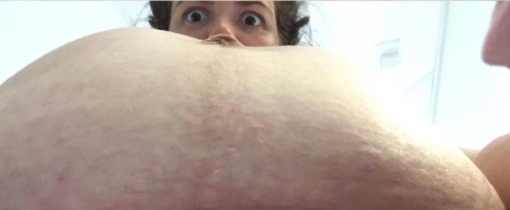 Mom Posts Before-and-After C-Section Photos of Belly