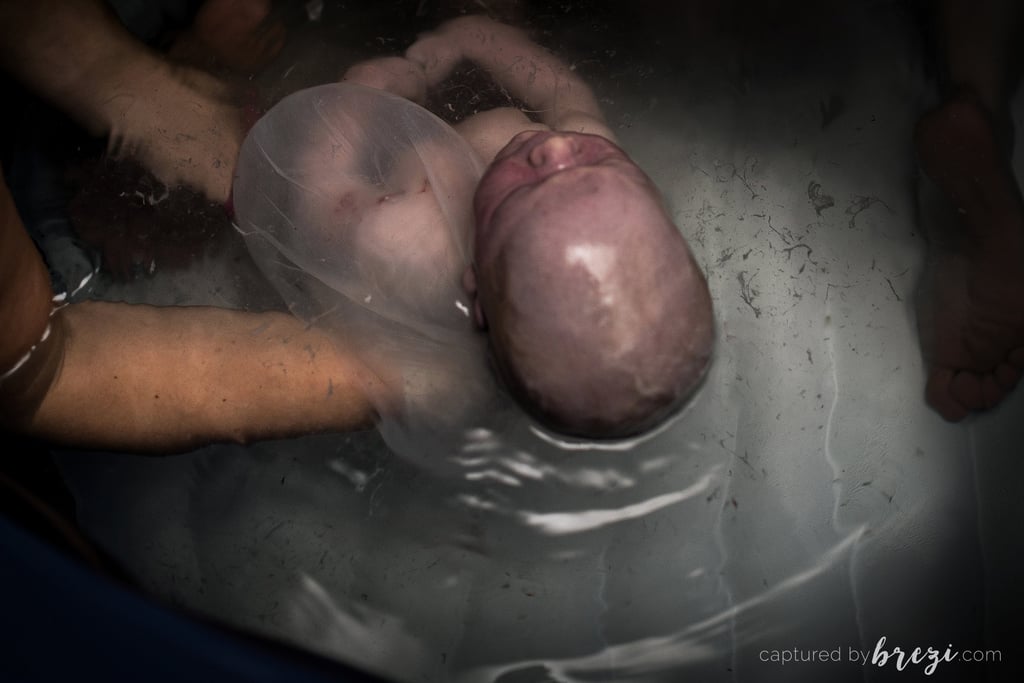 Baby Born En Caul and on Due Date