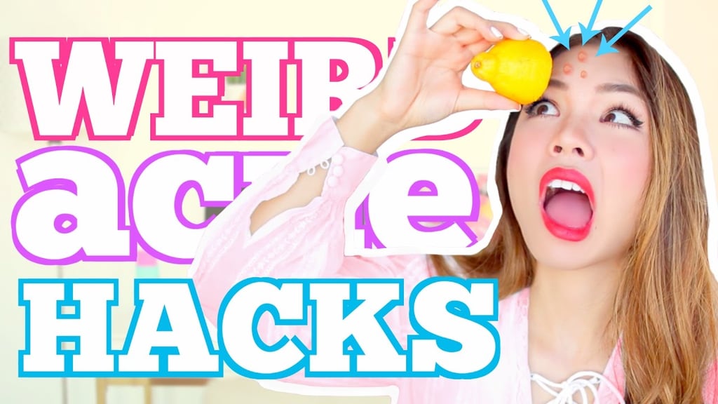 Crazy & WEIRD Acne Hacks TESTED!