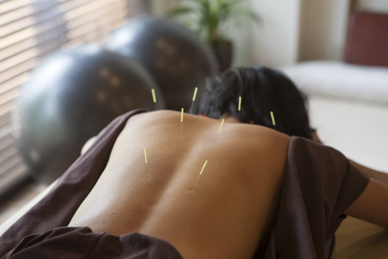 japanese female get acupuncture treatment in kyoto japan