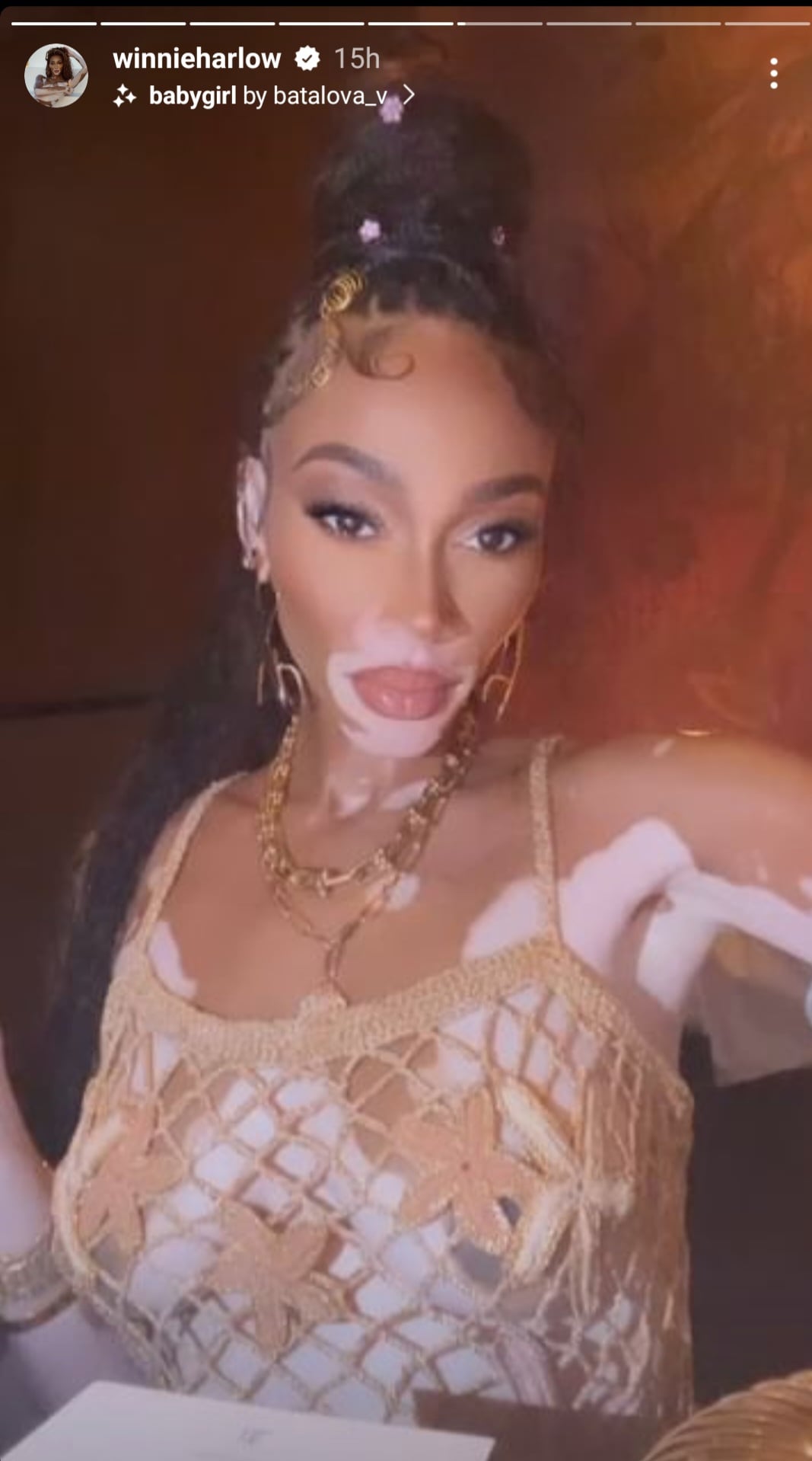 Winnie Harlow Just Wore the Most Gorgeous Fishnet Dress With