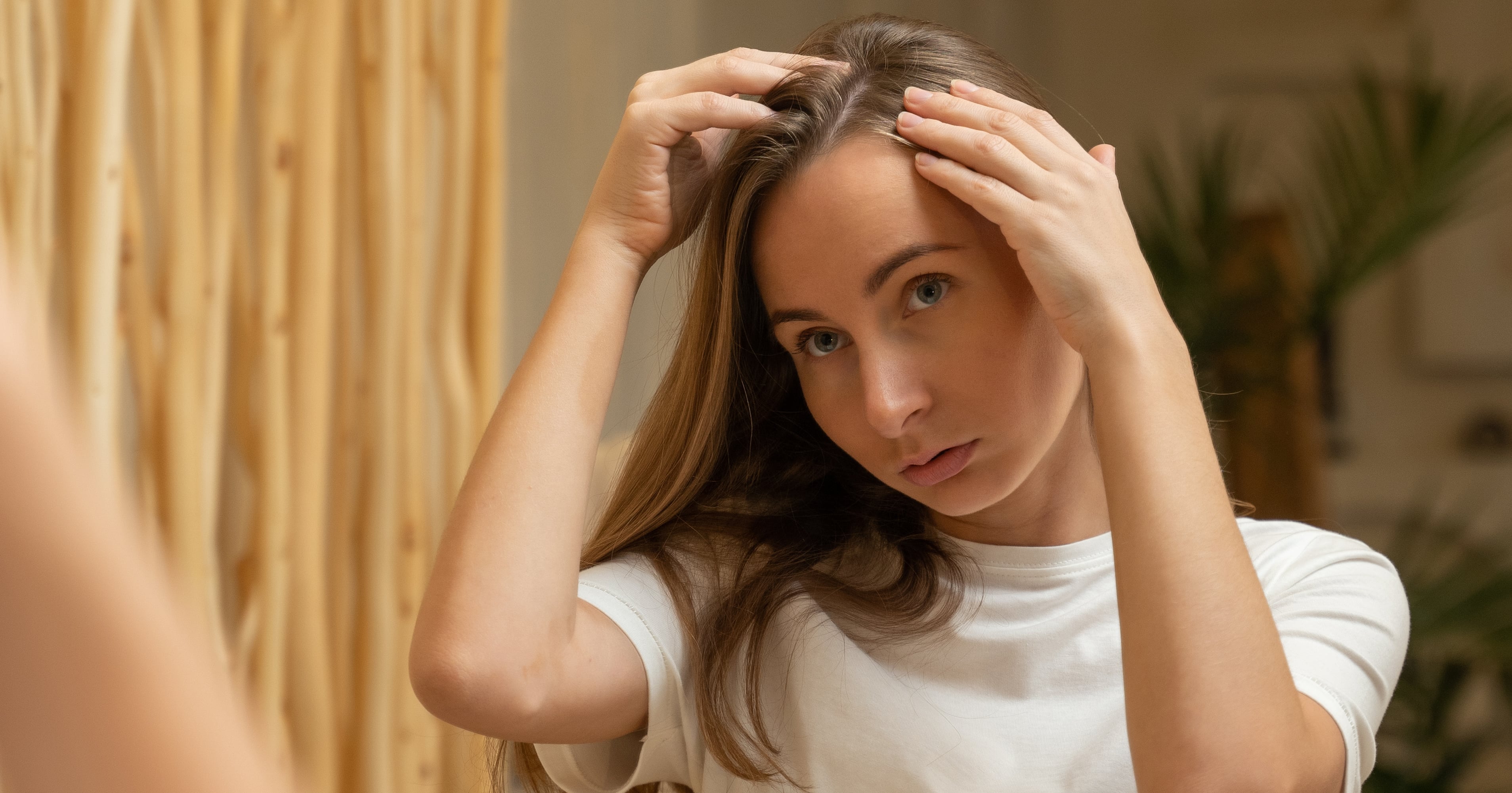 What Is Dandruff? Experts Explain the Skin Condition