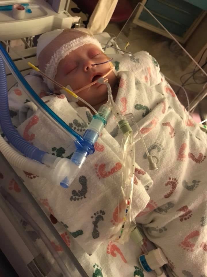 Baby Gets Hit in the Head With a Softball POPSUGAR Family