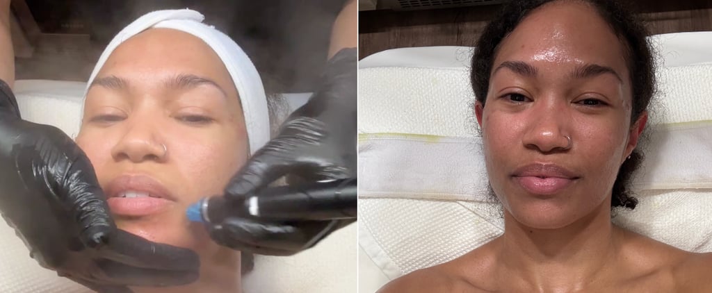 What Is a HydraFacial and How Does It Help Skin?