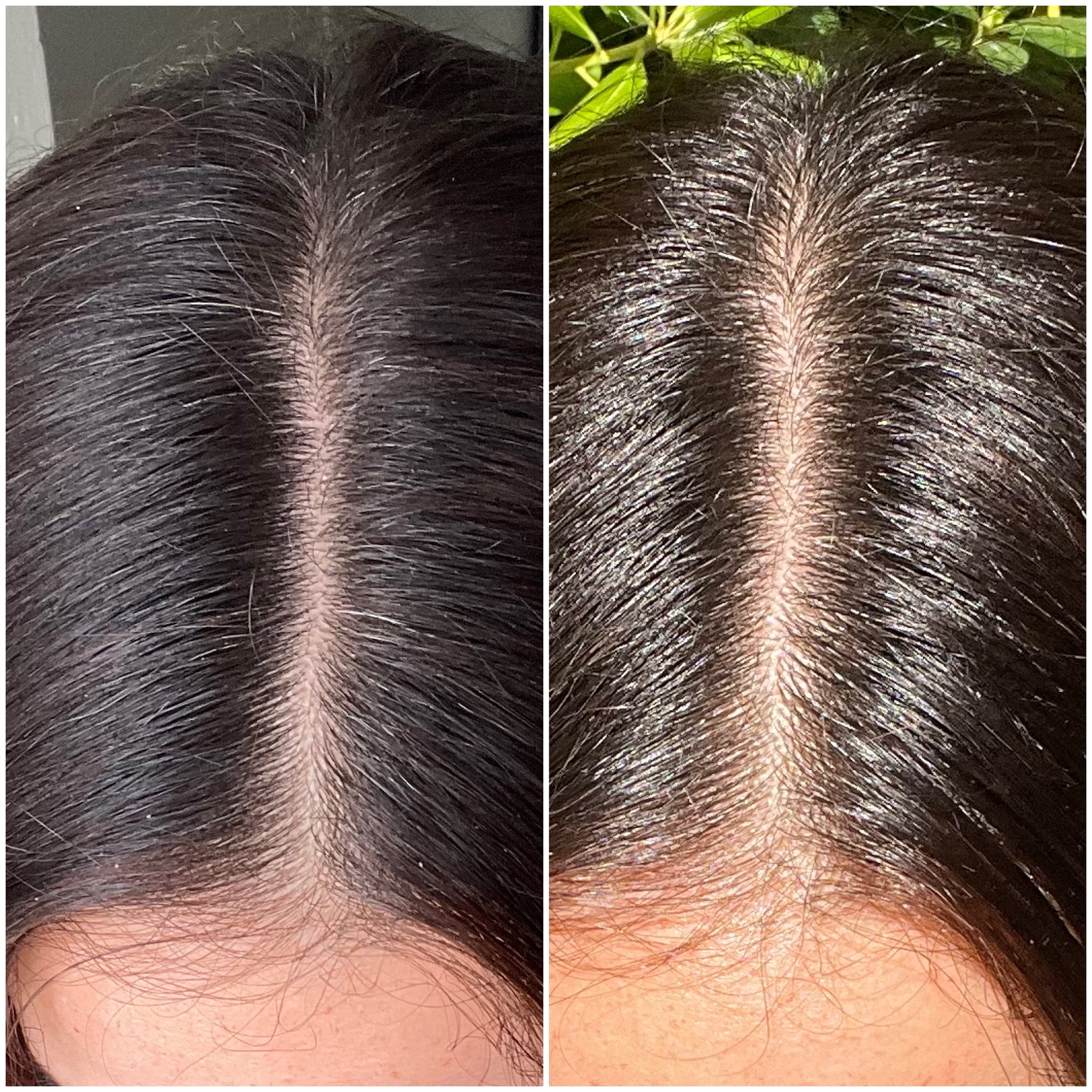 Scalp Detox Editor Experiment