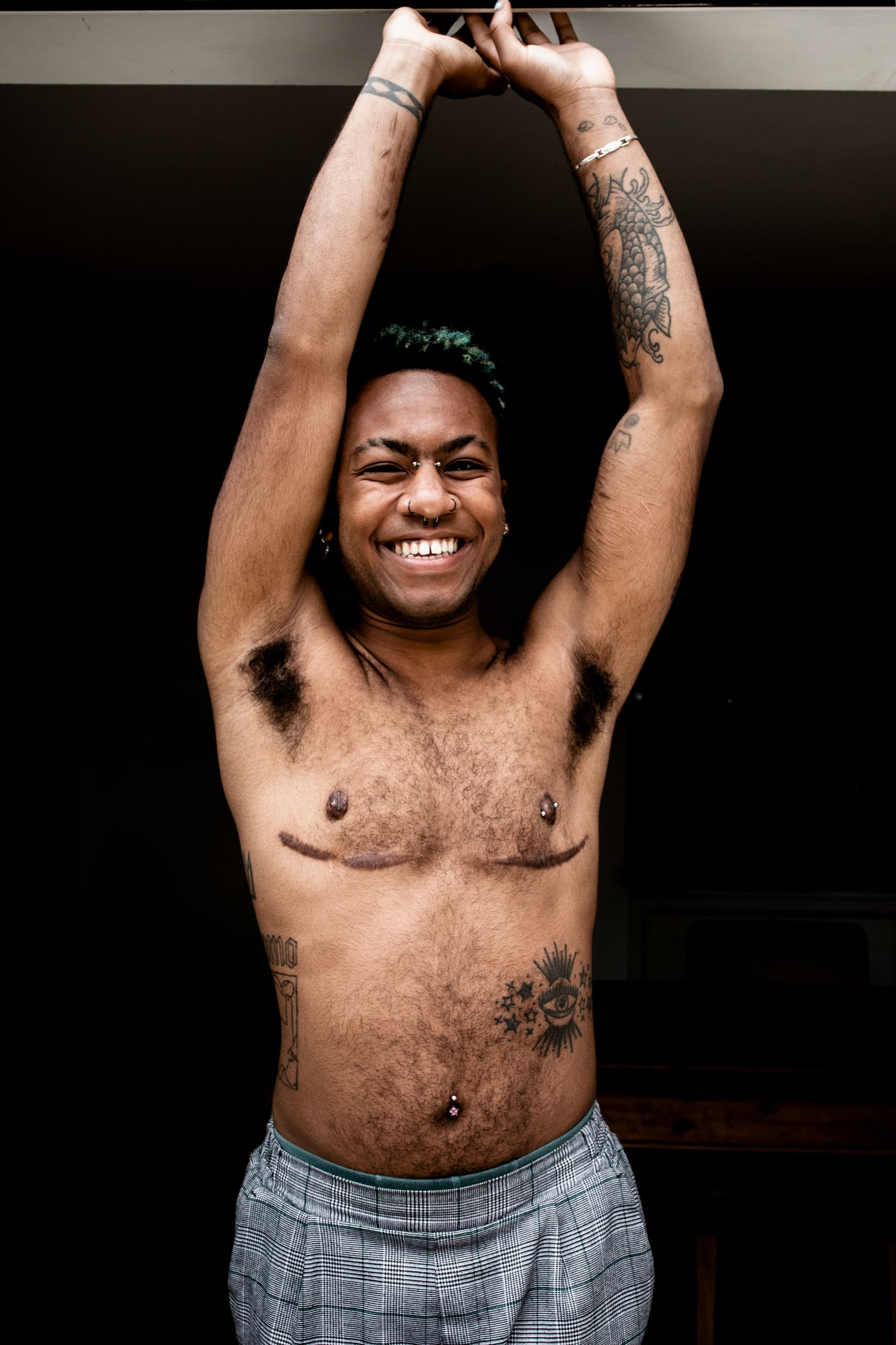 Top-Surgery Scars: Types, Scar Treatments, Cover-Up Tattoos | PS Beauty