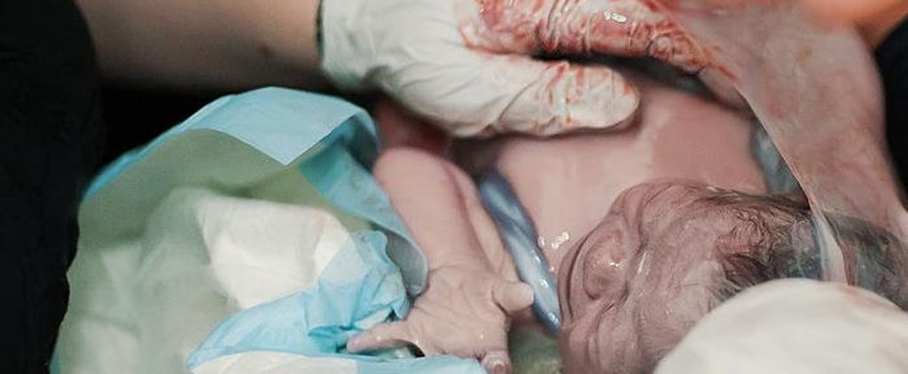 Photos of Babies Born En Caul