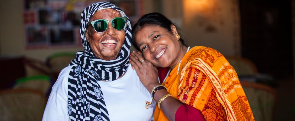 Acid Attack Survivor Story