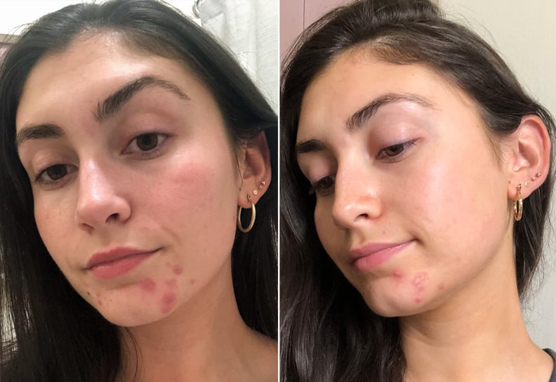 Before and After: Two Weeks