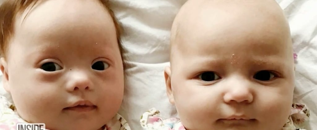 Rare Set of Twins Where Only One Baby Has Down Syndrome