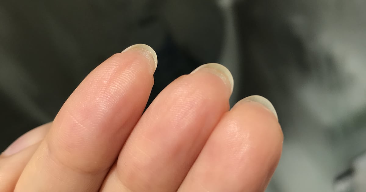 Why your skin grows under your nails