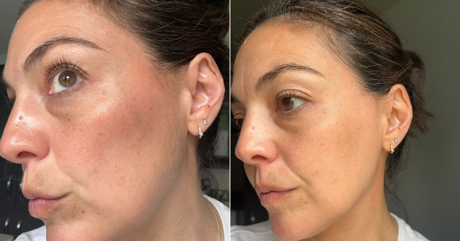 I Tried Dermaplaning and These are the Results PS UK Beauty