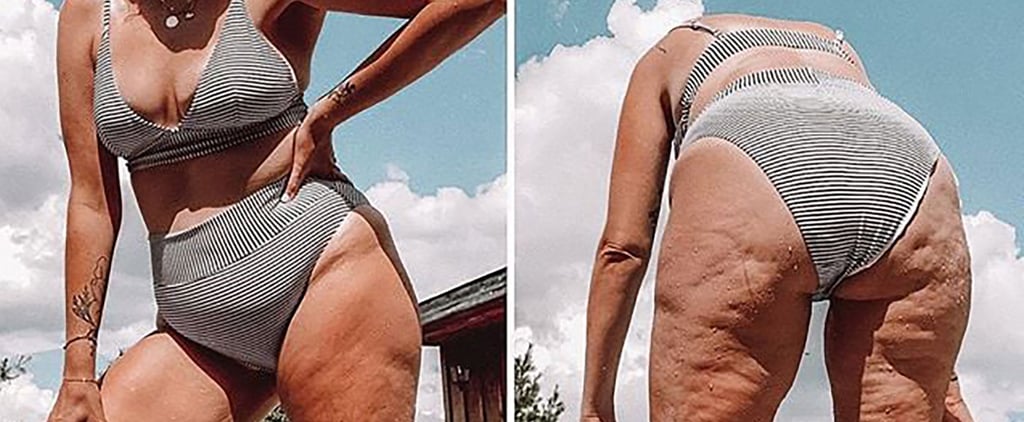 Body-Positive Mom Posts Photos of Cellulite: "We Aren't Here to Ornament the Sides of Pools"