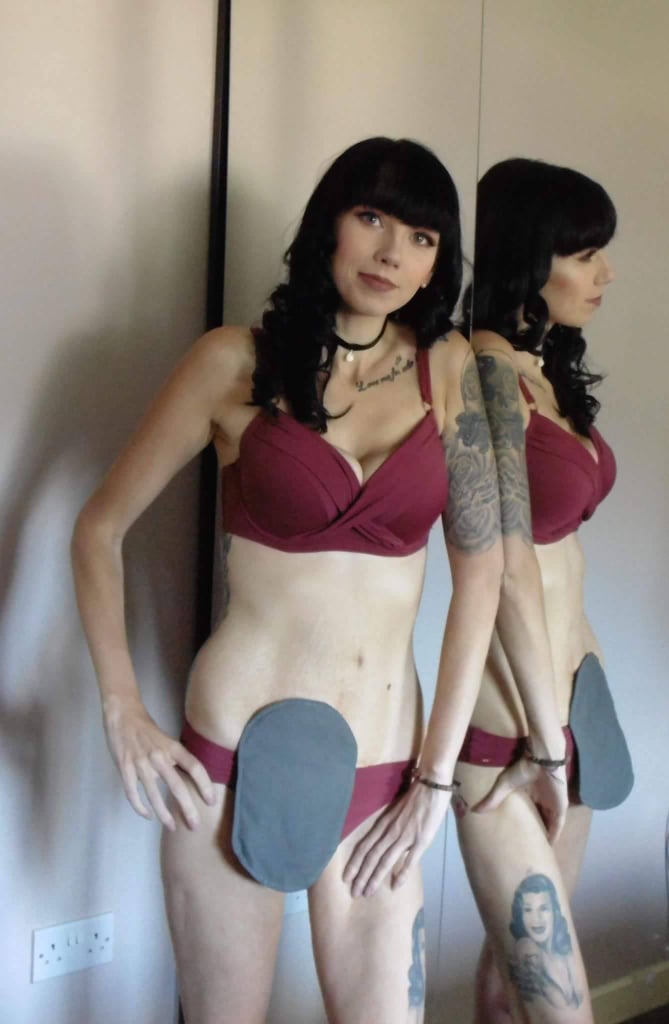 Woman With Urostomy Bag Lingerie Photos