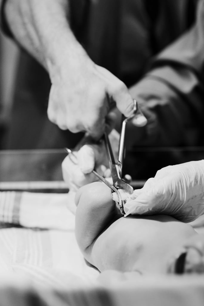 Dramatic C-Section Birth Photos