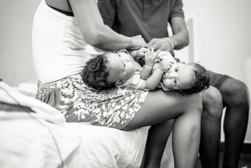Photographer Captures the Beauty of Conjoined Twins