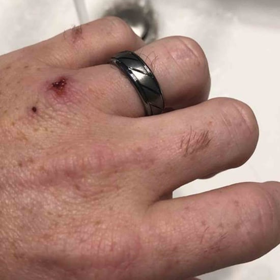 Why This Husband Cleans His Wedding Ring Every Week