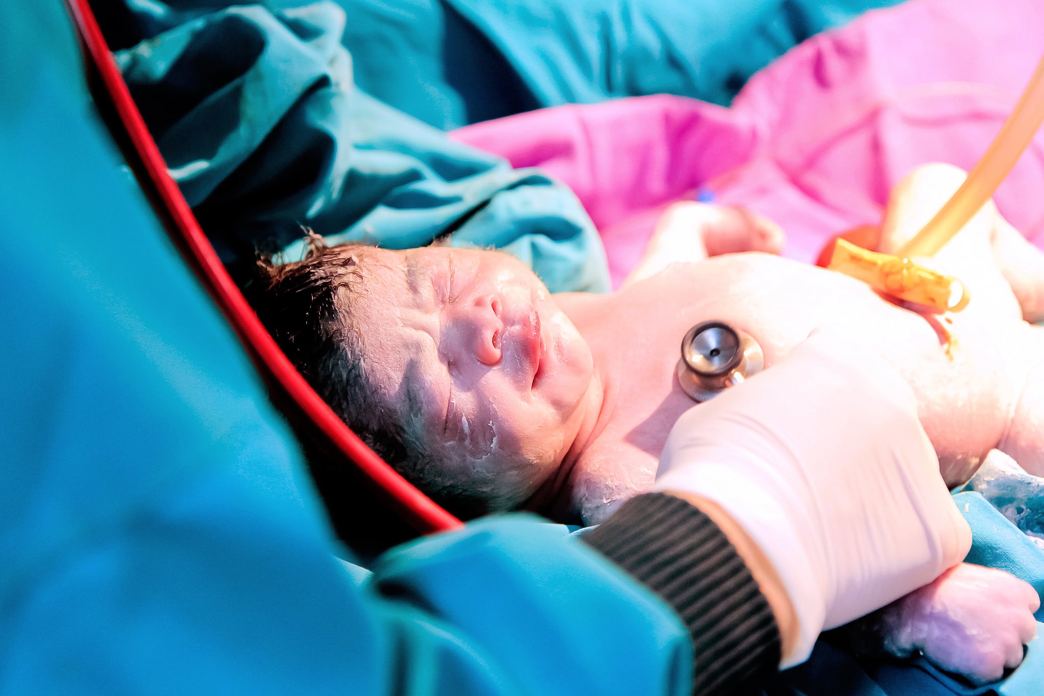 C-Sections Are the Easy Way to Give Birth | POPSUGAR Family