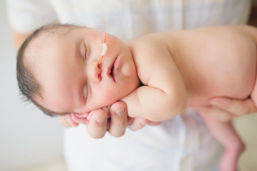 Newborn With Inoperable Tumor in Family Photos