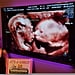 Twins Kissing in Sonogram