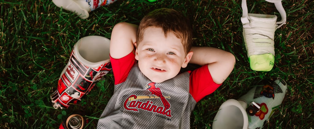 Photo Shoot of Toddler Who Lost Both Legs